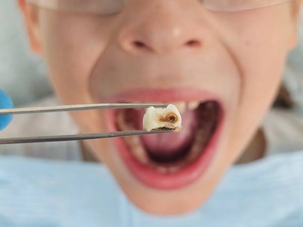 Best Emergency Dentist for Special Needs Patients in Edmond, OK