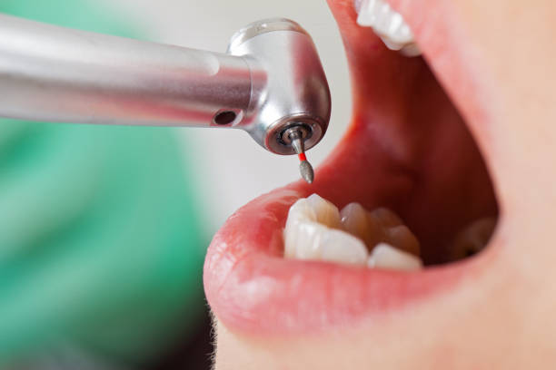 Best Emergency Cosmetic Dentistry in Edmond, OK